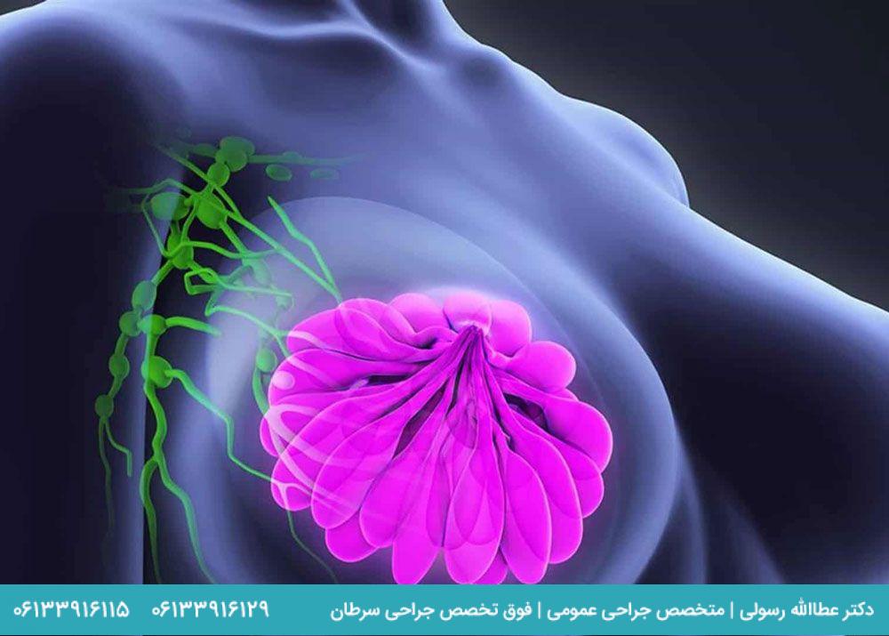 احتمال-شیوع-سرطان-سینه-از-چه-سنی-شروع-میشود